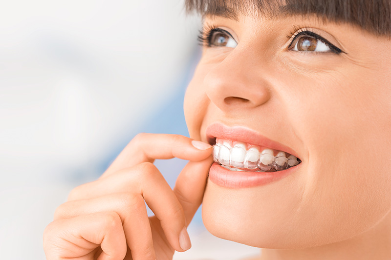 Clear Aligner Therapy in Pompton Plains